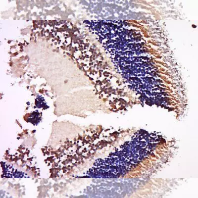 Epigenetics
