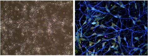 Immunofluorescence showing neuronal cell activity maintained by Fibronectin
