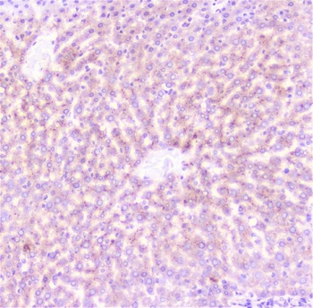 CRP Antibody Staining
