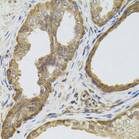 EGFR Staining