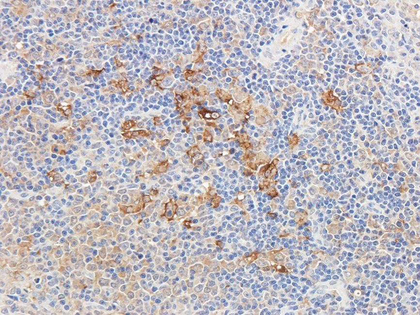 Knockdown Validation Blot for Ferritin Antibody