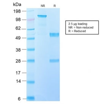 Knockdown Validation Blot for IL-10 Antibody
