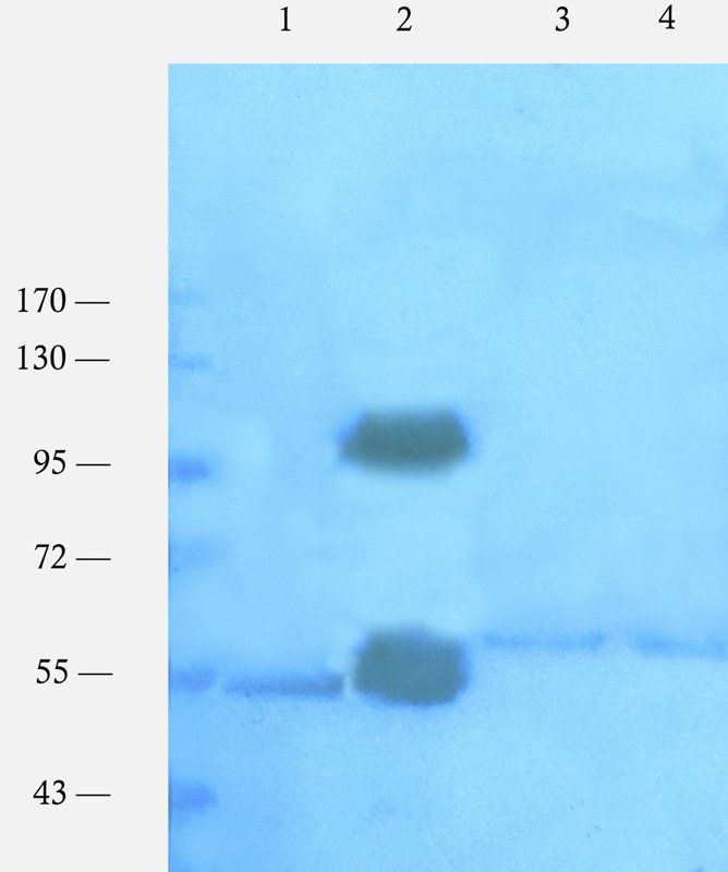 Nrf2 Antibody Staining