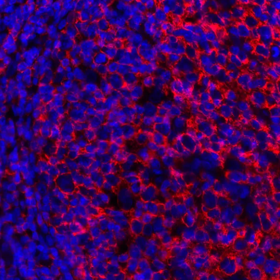 Mouse anti-CD20 Antibody