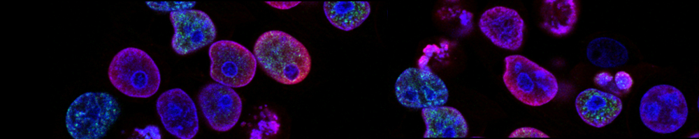 Spatial Biology and IHC