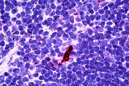 EBI3 antibody