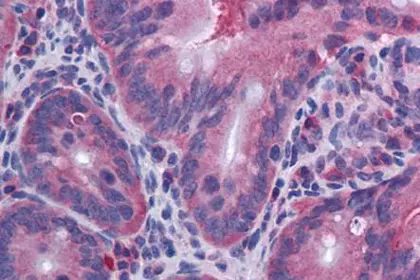 IL 10 antibody
