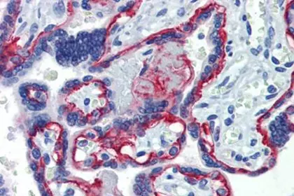 Integrin Beta 4 antibody