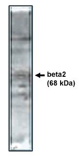 Rabbit anti Human Calcium Channel