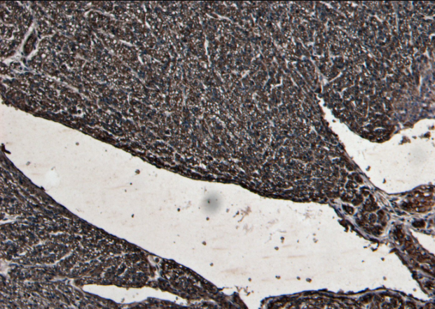 Desmin Antibody