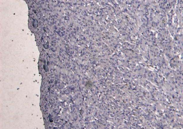 Desmin Antibody