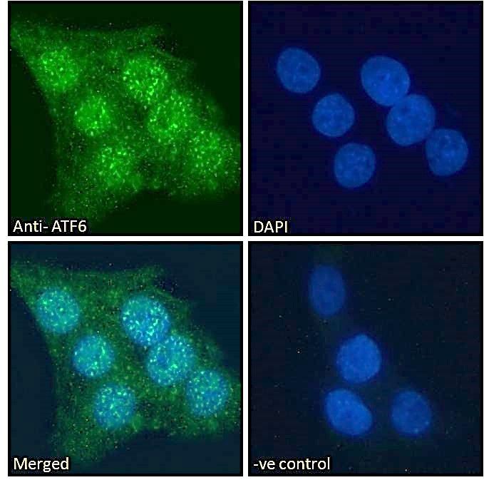 ATF6 (aa437-449) Antibody