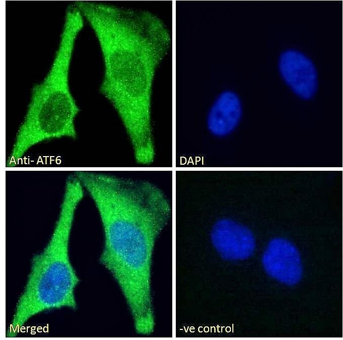 ATF6 (aa437-449) Antibody