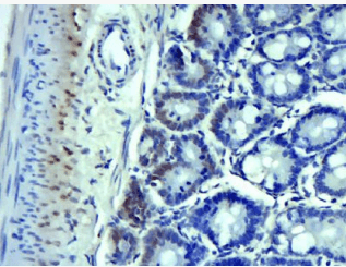 SMYD2 Rabbit Polyclonal Antibody (FITC)