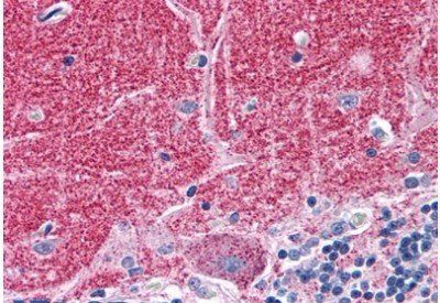 Septin 3 Antibody