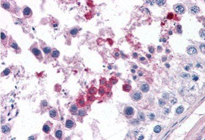 Septin 3 Antibody