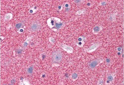 Septin 3 Antibody