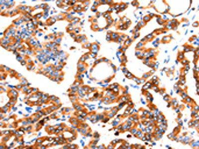 SEPT4 Antibody