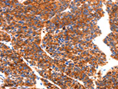 SEPT4 Antibody