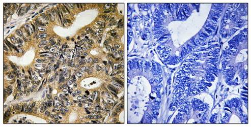4E-BP1 (Phospho-Thr70) Antibody