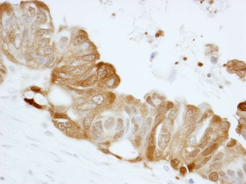 Rabbit anti-14-3-3 Sigma IHC Antibody, Affinity Purified