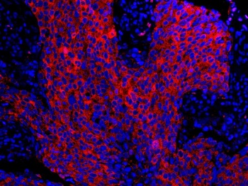 Rabbit anti-14-3-3 Sigma IHC Antibody, Affinity Purified