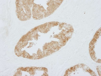 Rabbit anti-14-3-3 Sigma IHC Antibody, Affinity Purified