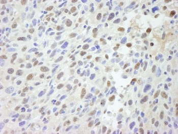 Rabbit anti-MED12 IHC Antibody, Affinity Purified