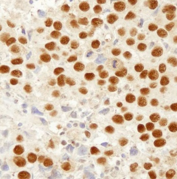 Rabbit anti-MSH2 IHC Antibody, Affinity Purified