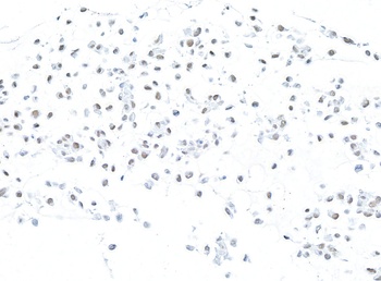 Rabbit anti-MSH2 Recombinant Monoclonal Antibody [BLR116H]