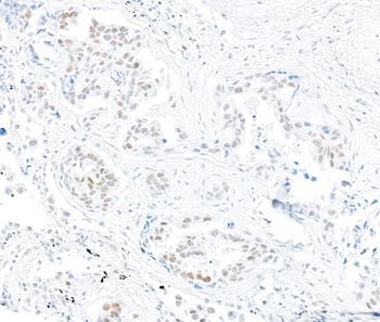 Rabbit anti-MSH2 Recombinant Monoclonal Antibody [BLR116H]