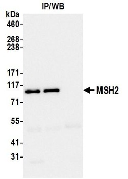 Rabbit anti-MSH2 Recombinant Monoclonal Antibody [BLR116H]