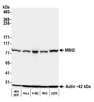 Rabbit anti-MSH2 Recombinant Monoclonal Antibody [BLR116H]