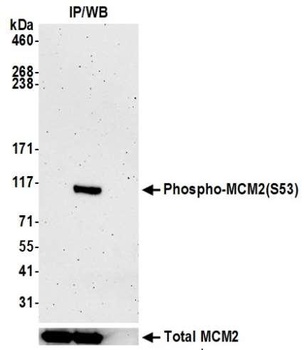 Rabbit anti-Phospho MCM2 (S53) Recombinant Monoclonal Antibody [BLR108H]
