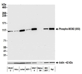 Rabbit anti-Phospho MCM2 (S53) Recombinant Monoclonal Antibody [BLR108H]