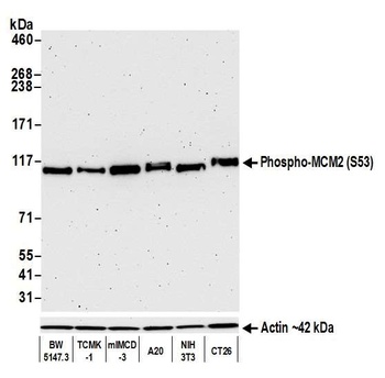 Rabbit anti-Phospho MCM2 (S53) Recombinant Monoclonal Antibody [BLR108H]
