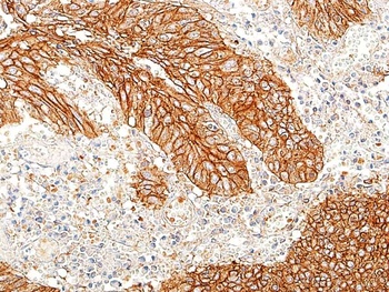 Rabbit anti-E-Cadherin Recombinant Monoclonal Antibody [BLR088G]
