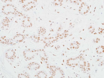 Rabbit anti-MED12 Recombinant Monoclonal Antibody [BLR084G]