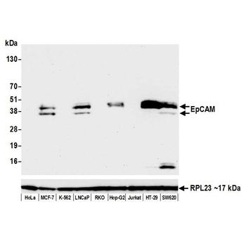 Rabbit anti-EpCAM Recombinant Monoclonal Antibody [BLR077G]