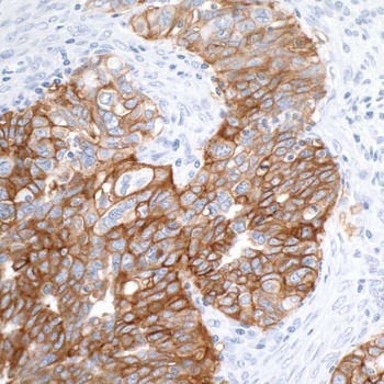 Rabbit anti-EpCAM Recombinant Monoclonal Antibody [BLR077G]