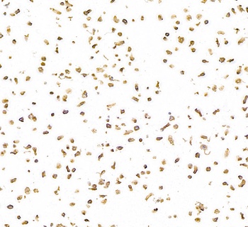 Rabbit anti-CD30 Recombinant Monoclonal Antibody [BLR055F]