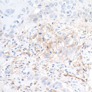 Rabbit anti-CD73 Recombinant Monoclonal Antibody [BLR054F]