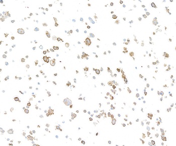 Rabbit anti-CD137 Recombinant Monoclonal Antibody [BLR051F]