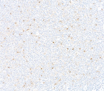 Rabbit anti-CD137 Recombinant Monoclonal Antibody [BLR051F]