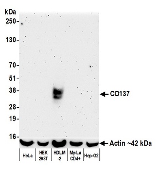 Rabbit anti-CD137 Recombinant Monoclonal Antibody [BLR051F]