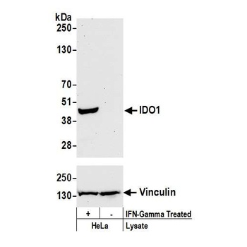Rabbit anti-IDO1 Recombinant Monoclonal Antibody [BLR040F]