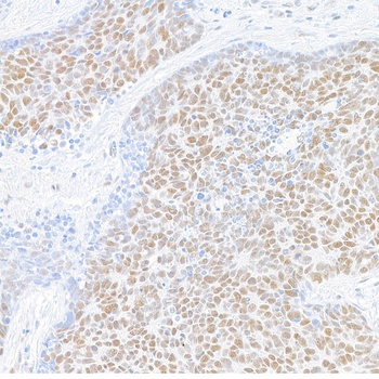Rabbit anti-MED1 Recombinant Monoclonal Antibody [BLR037F]