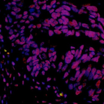 Rabbit anti-hSET1 Recombinant Monoclonal Antibody [BLR024E]
