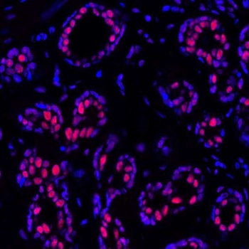 Rabbit anti-PBRM1 Recombinant Monoclonal Antibody [BL-39-2C3]