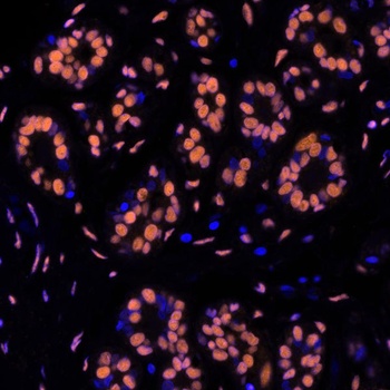 Rabbit anti-SMC1 Recombinant Monoclonal Antibody [BL-205-2G8]